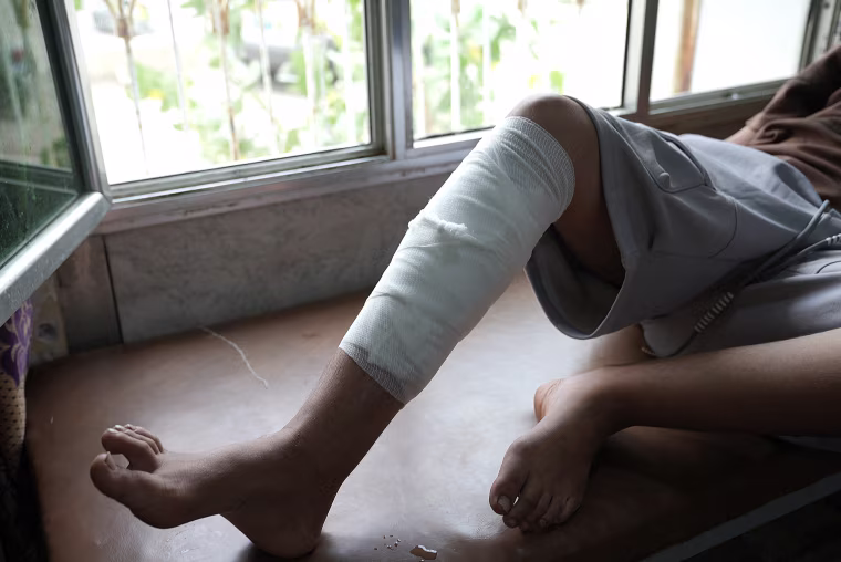 The bandaged leg of an adolescent sitting in front of a bank of windows.