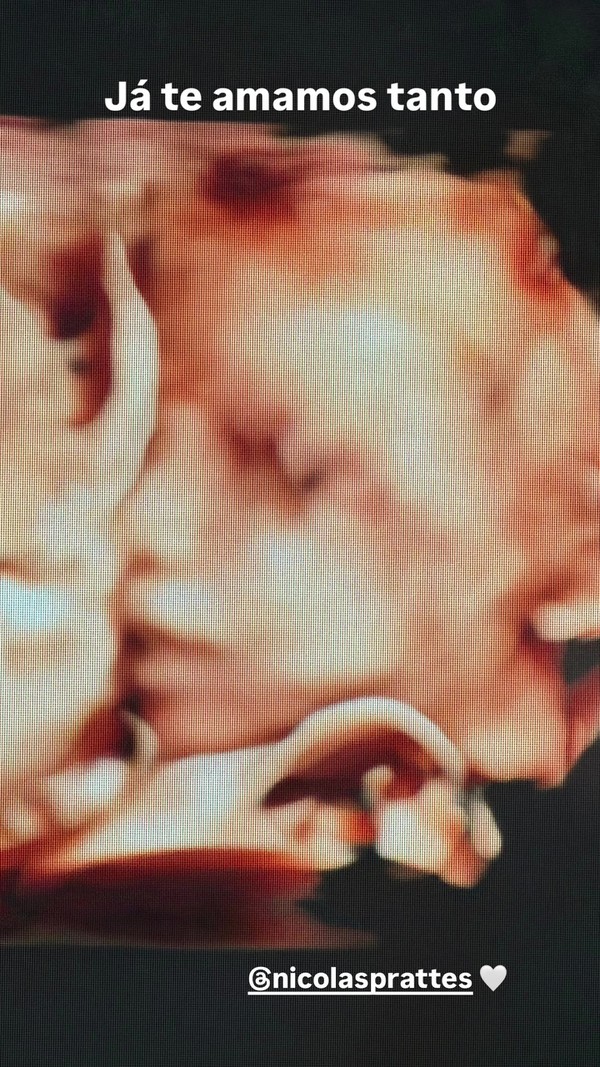 Sabrina Sato mostra rosto do bebê que espera com Nicolas Prattes: 'Já te amamos tanto'; foto